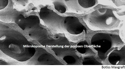 mikroskopische Darstellung der porösen Oberfläche